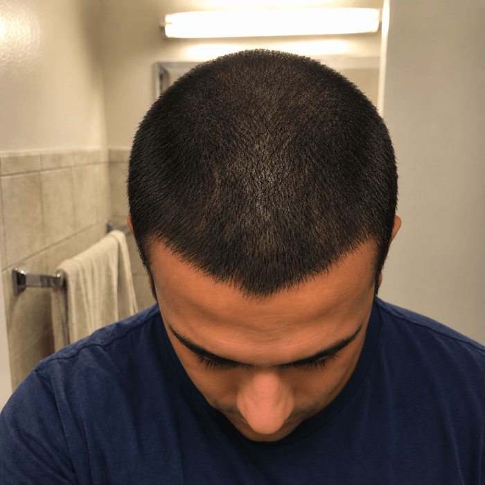Diffused thinning after