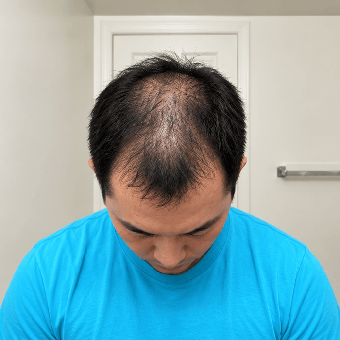 Top before