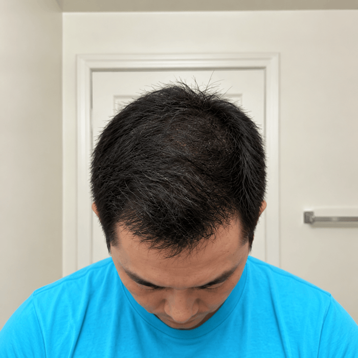 Top after