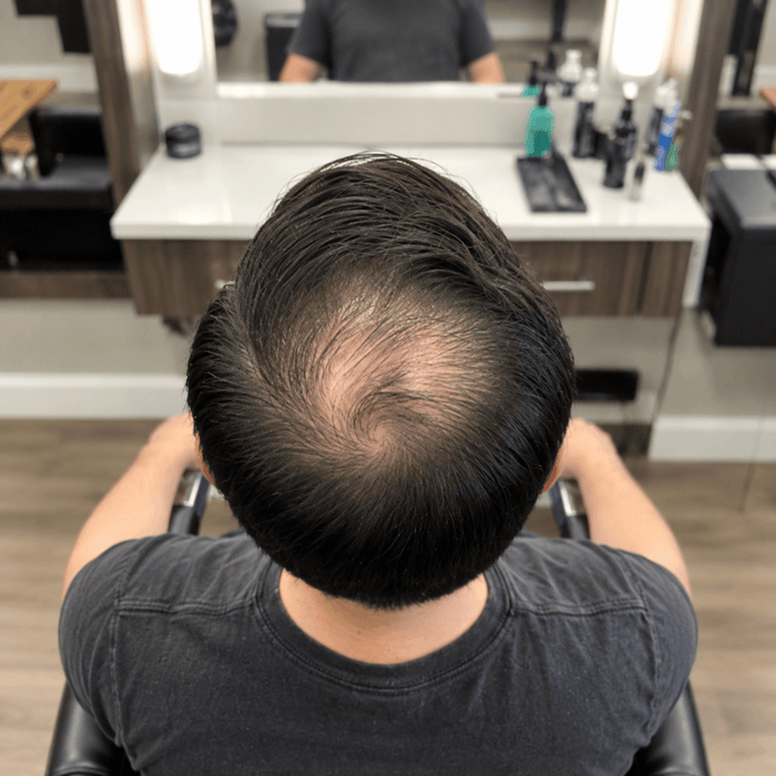 Crown before